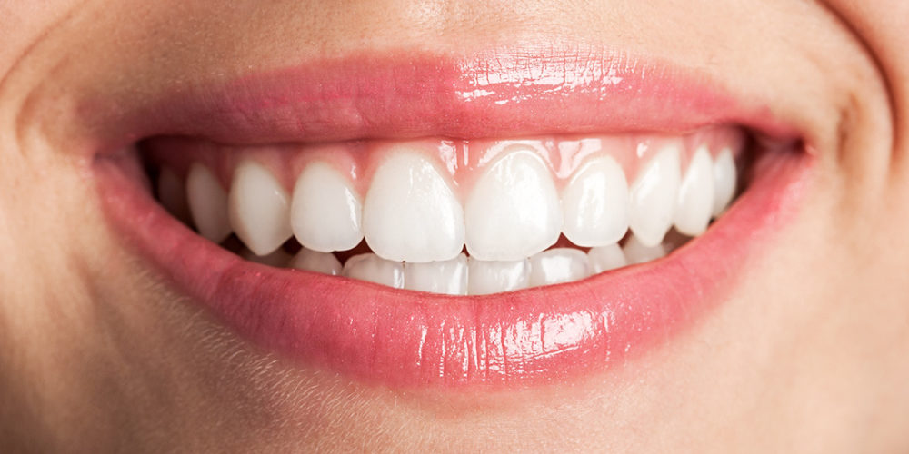 Estética Dental - Sonrisas | Morelló Clínica Dental en Barcelona