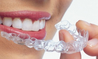 Invisalign: Ortodoncia Invisible | Morelló Clínica Dental en Barcelona